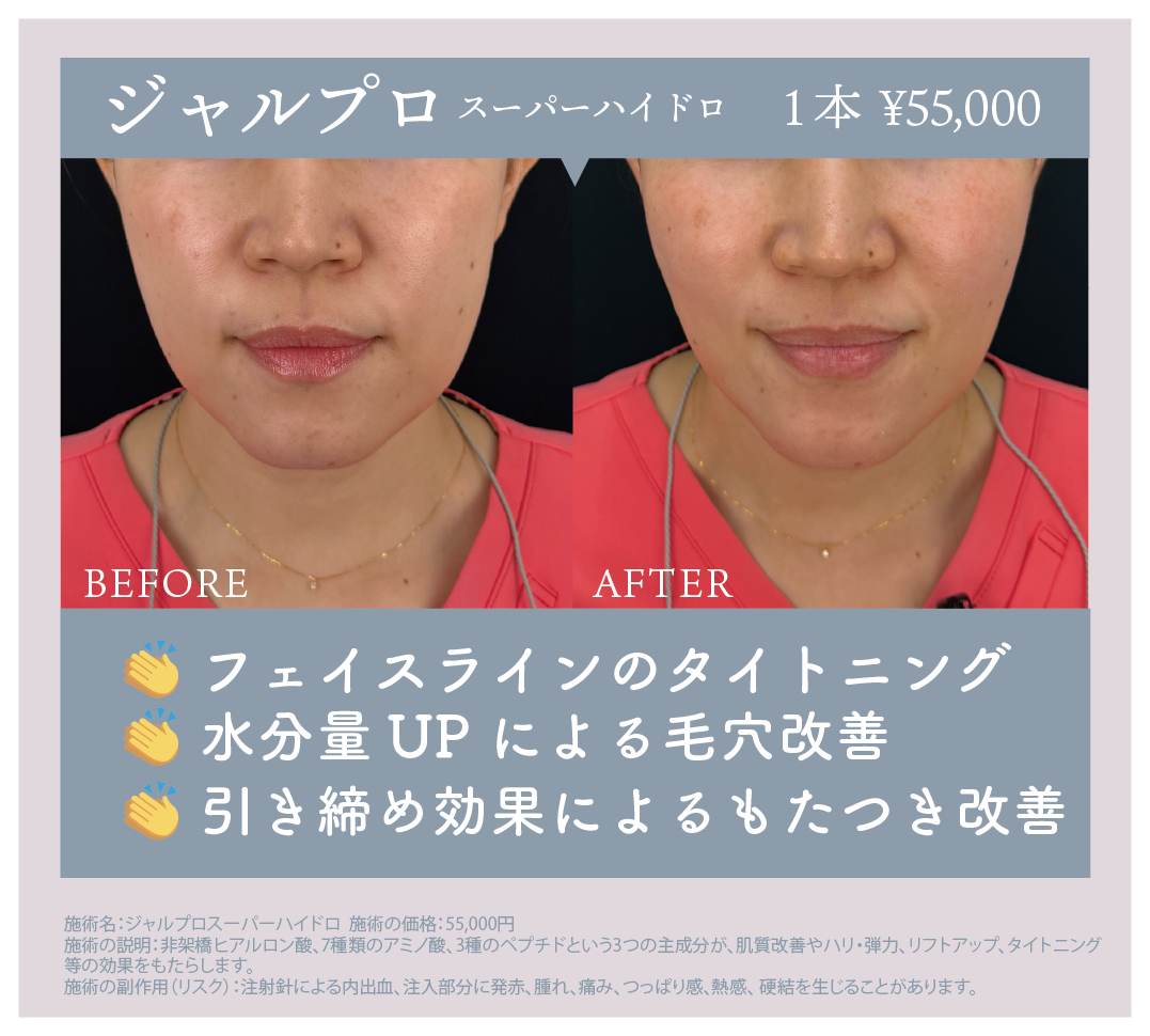 ジャルプロ スーパーハイドロ