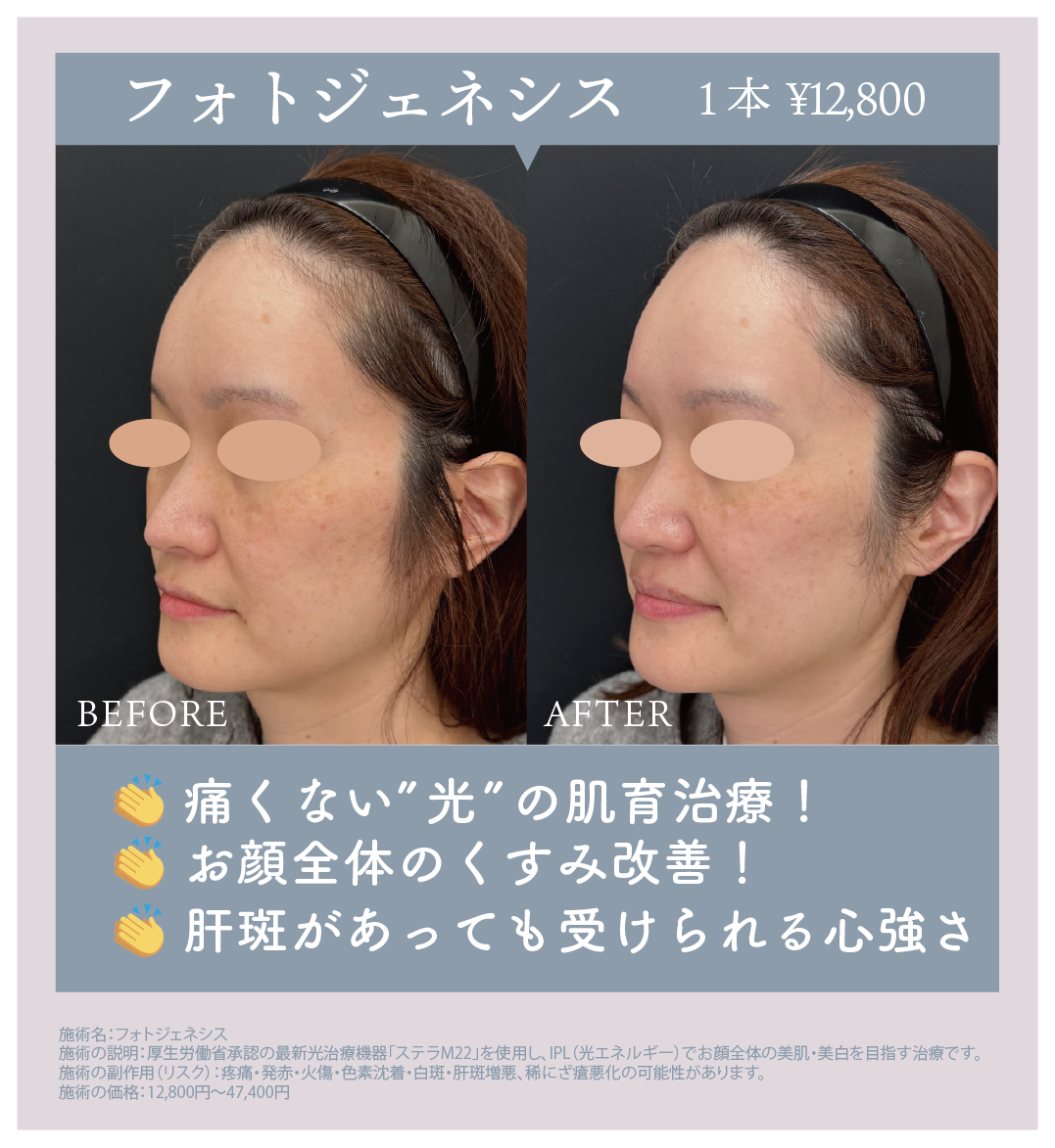 フォトジェネシス