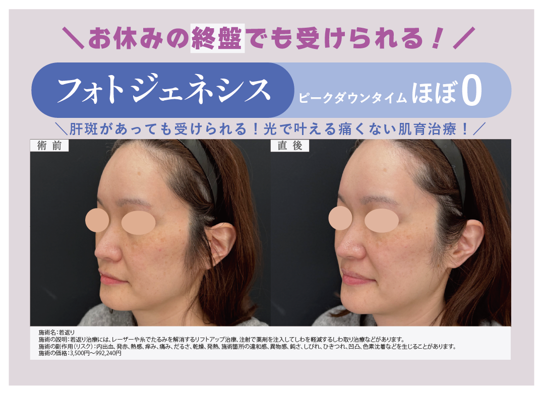 フォトジェネシス