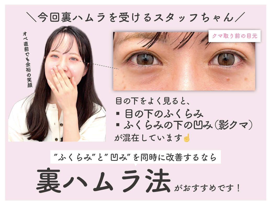 改善したいのは ”ふくらみと凹み”の両方