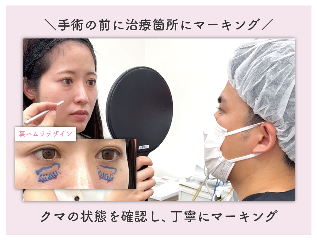 直接お顔にデザインを書き込む