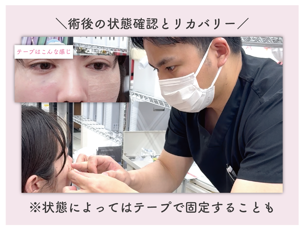 術後はテープで固定することも