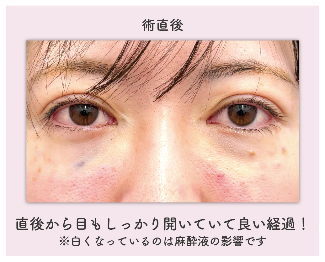 術直後