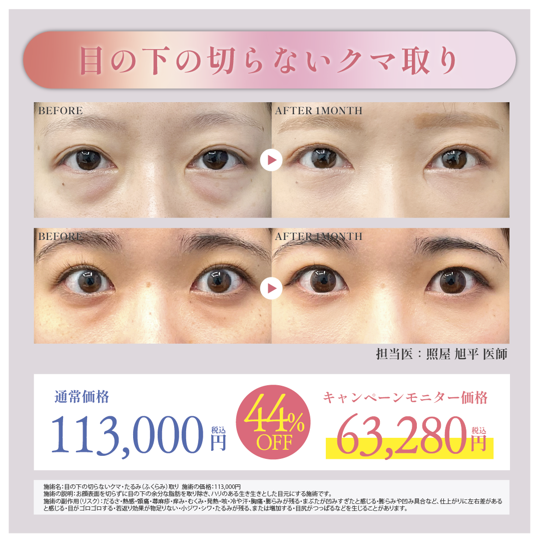 🔥モニター価格から20%OFF🔥