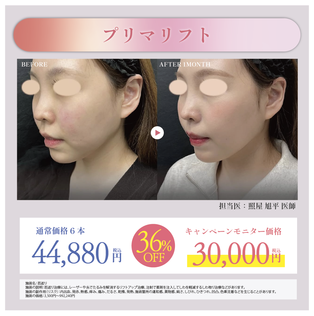 🔥プリマリフト1本¥5,000🔥