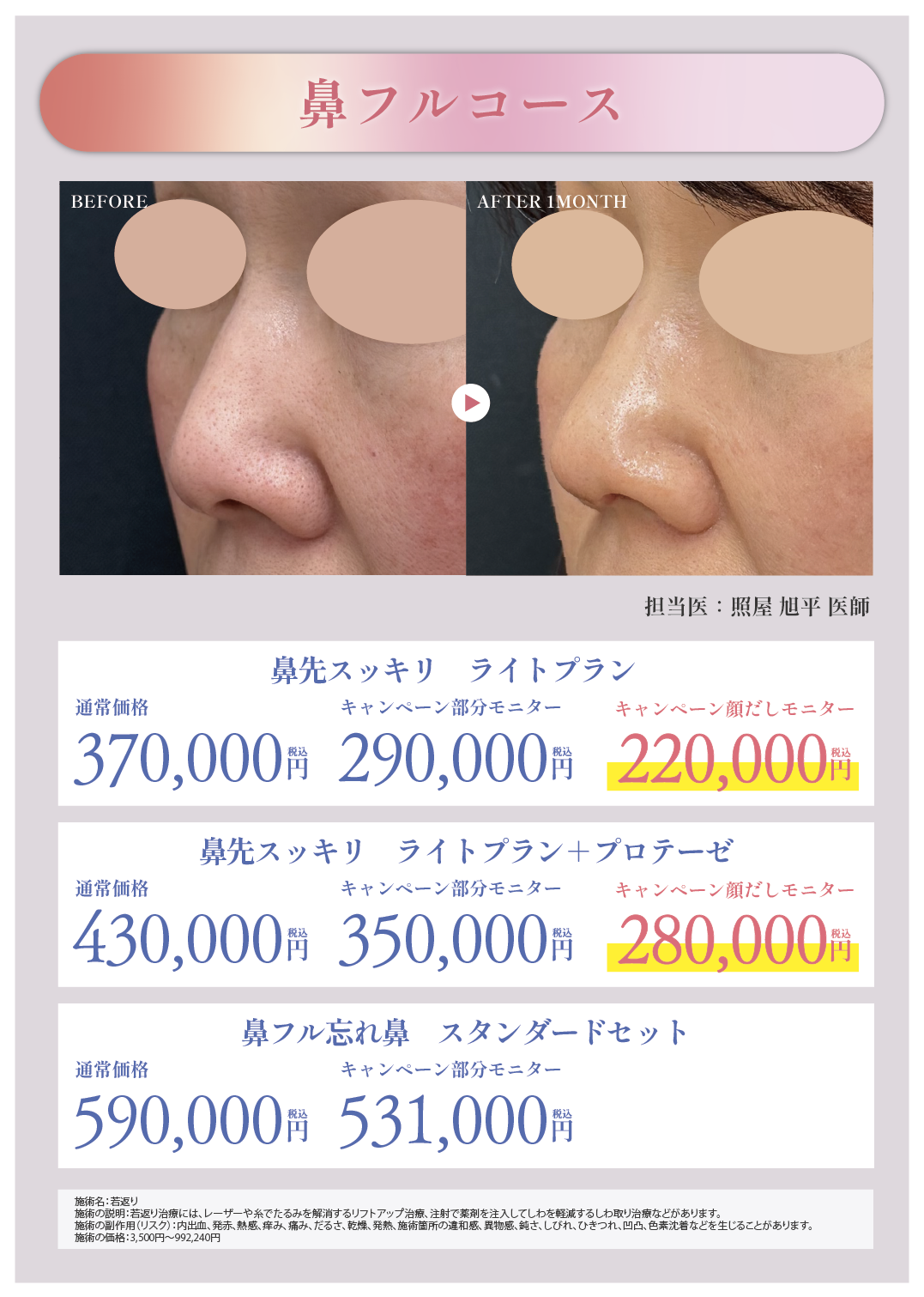 🔥モニター価格MAX40%OFF🔥