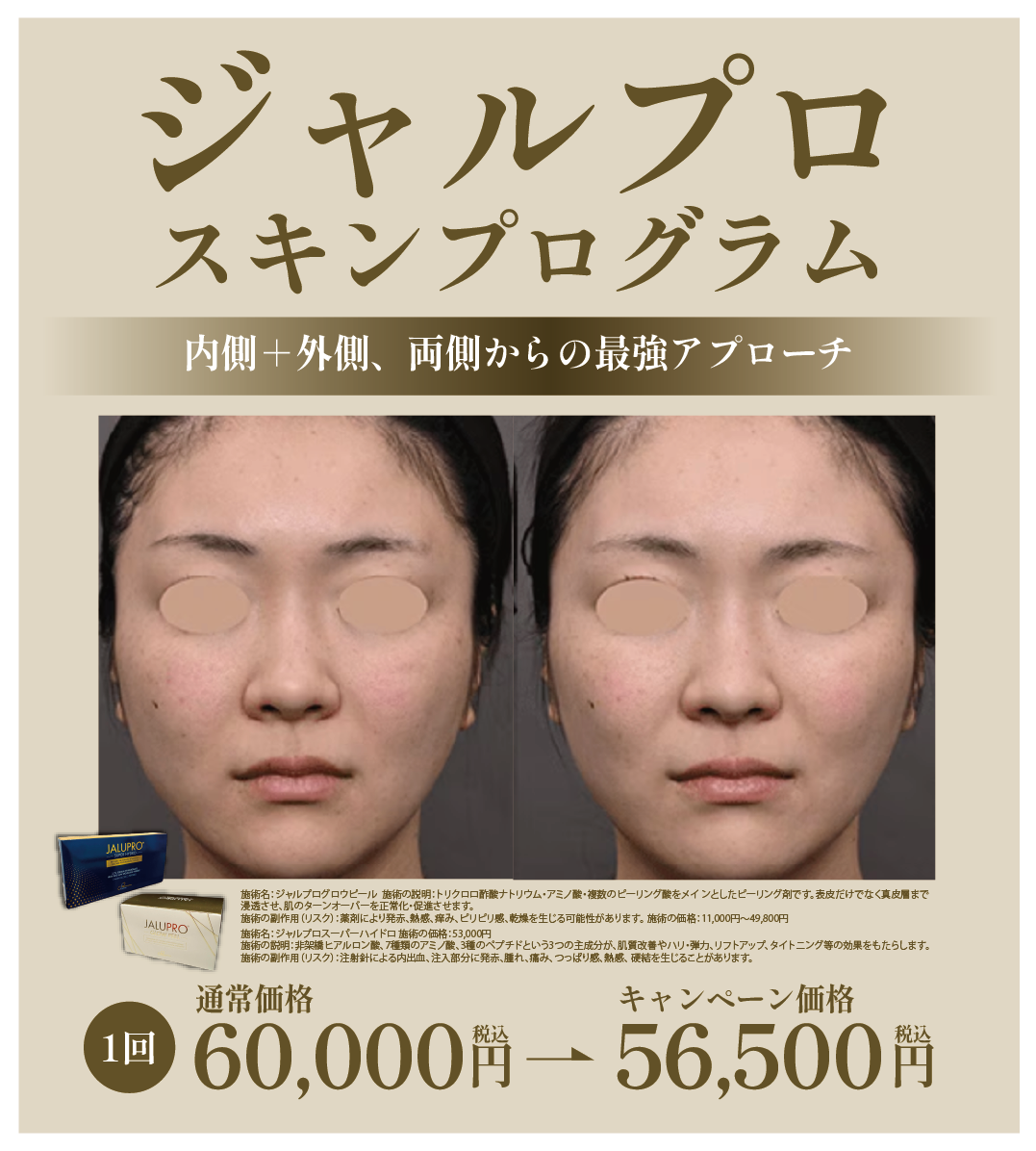 ジャルプロスキンプログラム