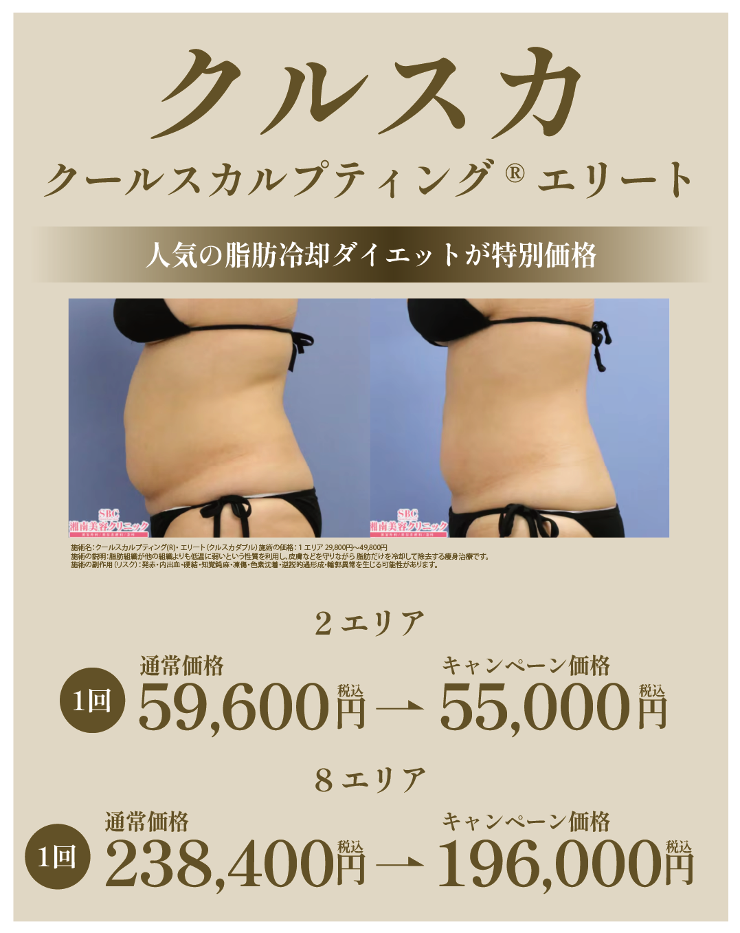 クールスカルプティング®︎エリート