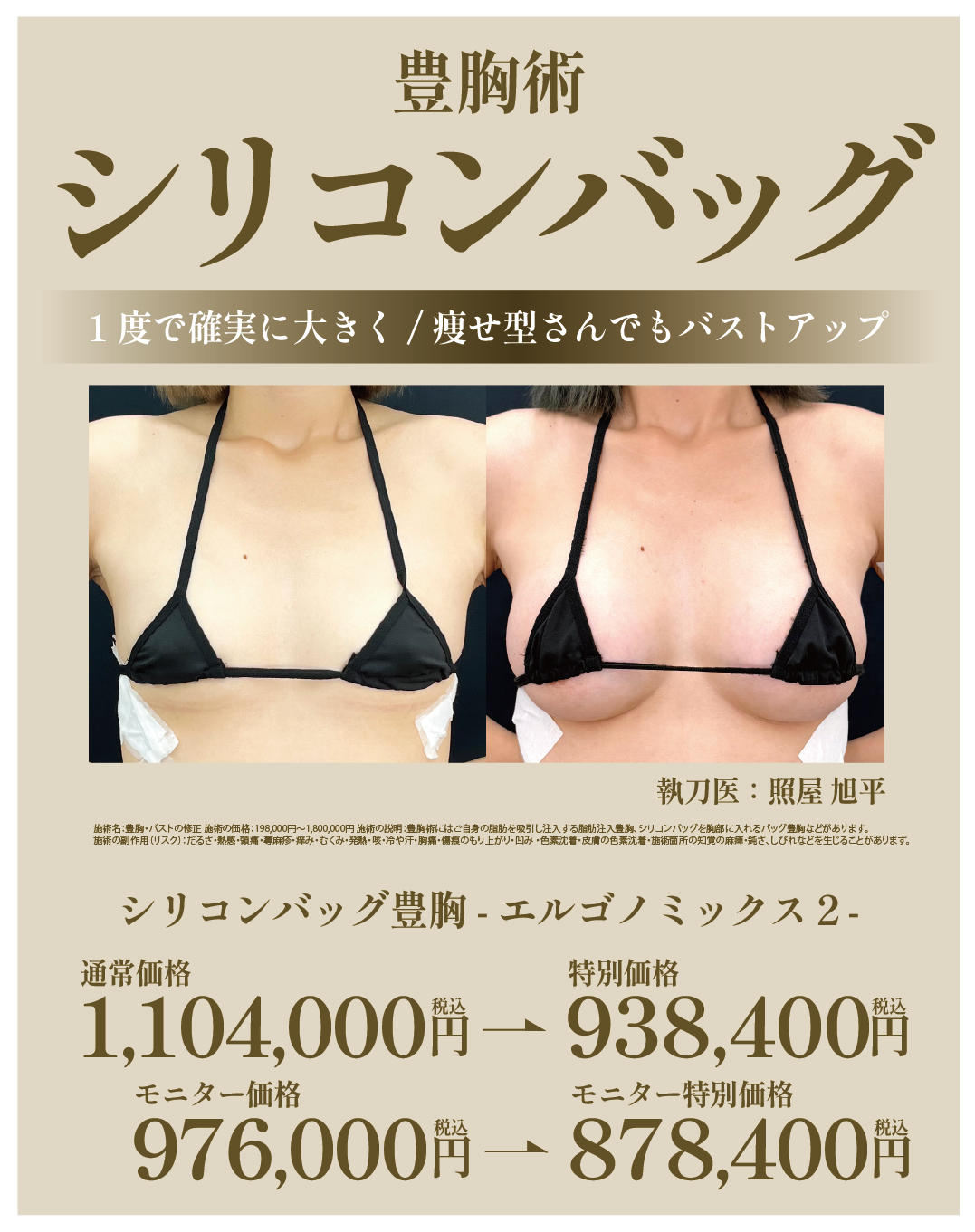 シリコンバッグ豊胸