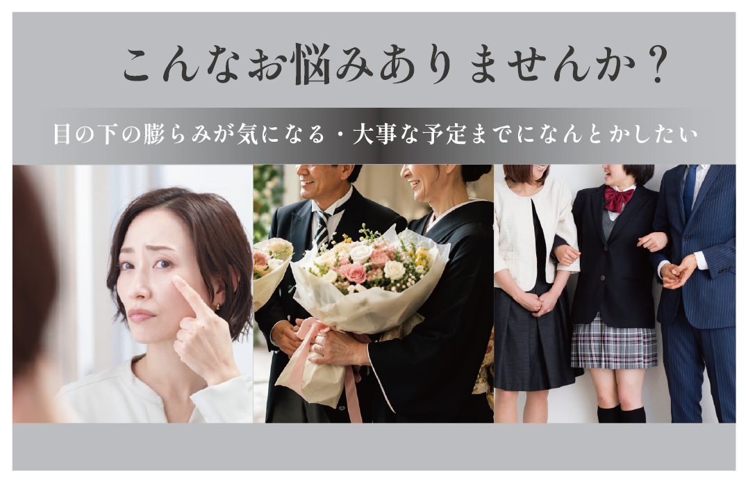 目の下の膨らみが気になる / 大事な予定までにクマ（膨らみ）を改善したい