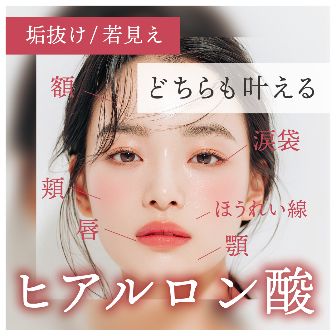 ヒアルロン酸|垢抜け・若返り治療なら湘南美容クリニック鹿児島中央院の楠元和歌子 医師 / 佐藤匡斗 医師にお任せください!