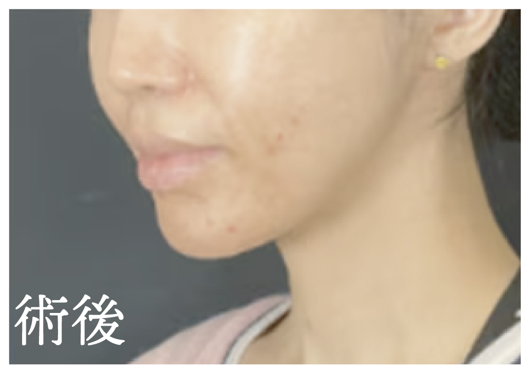 AFTER