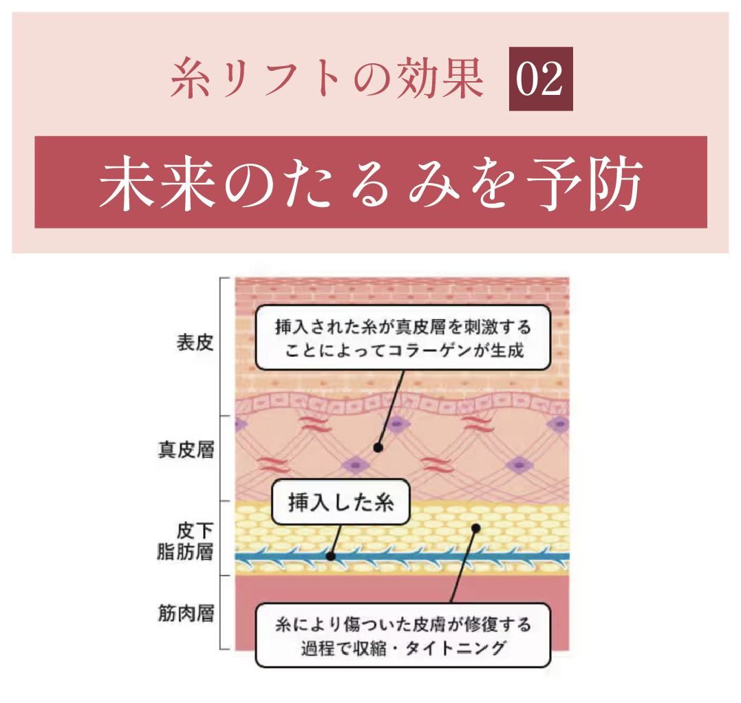効果② 未来のたるみ予防