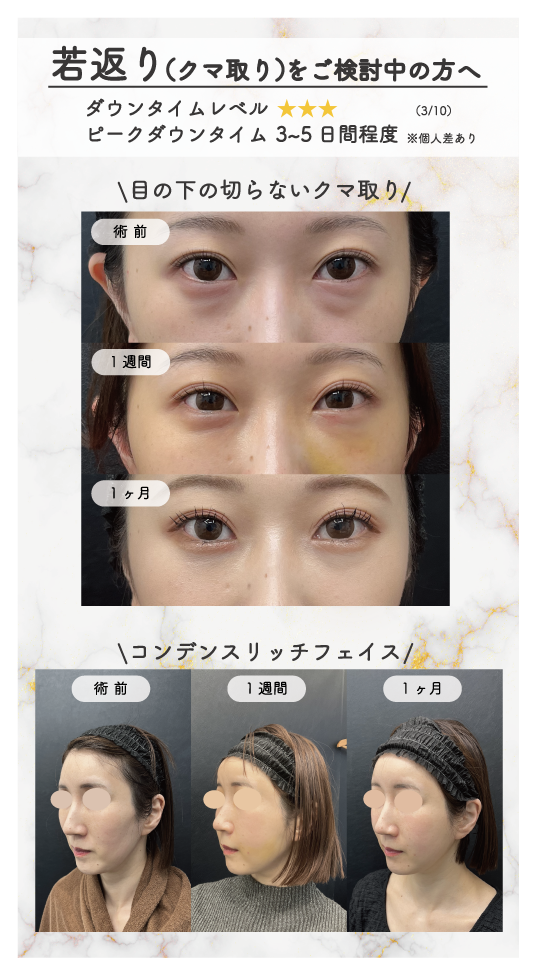 タイミングと隠し方がポイント！