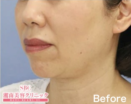 まずは試したい方！