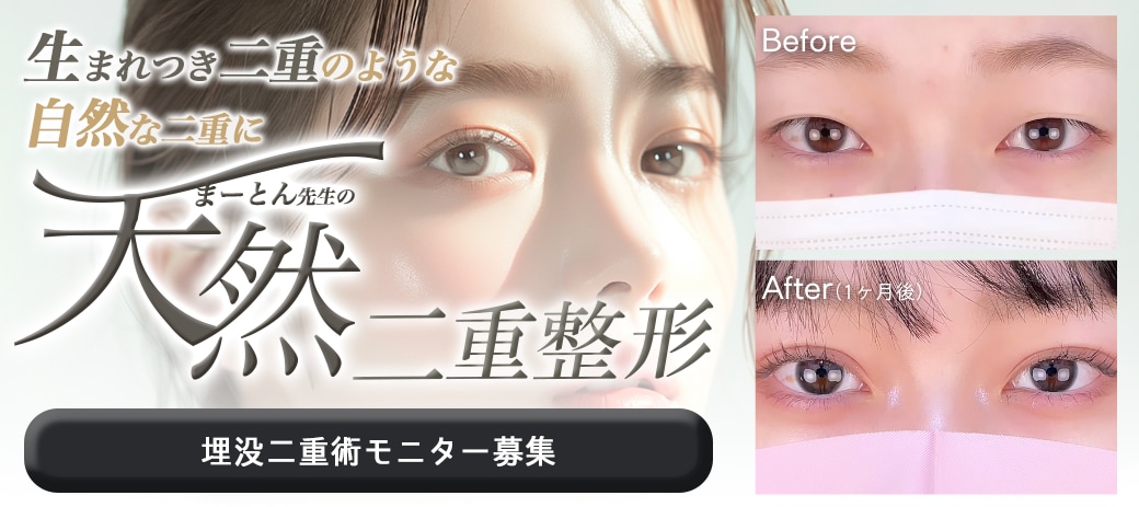 圧倒的美しさ『天然二重整形』の秘密