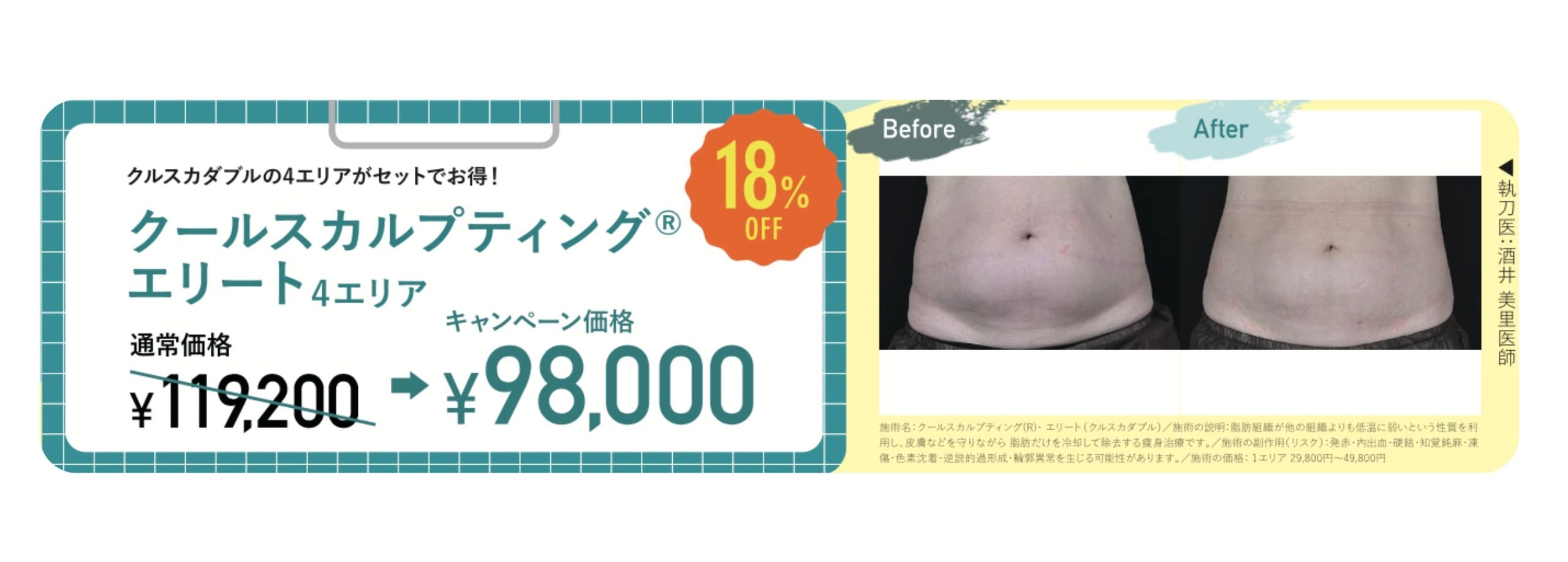 クールスカルプティング®エリート
