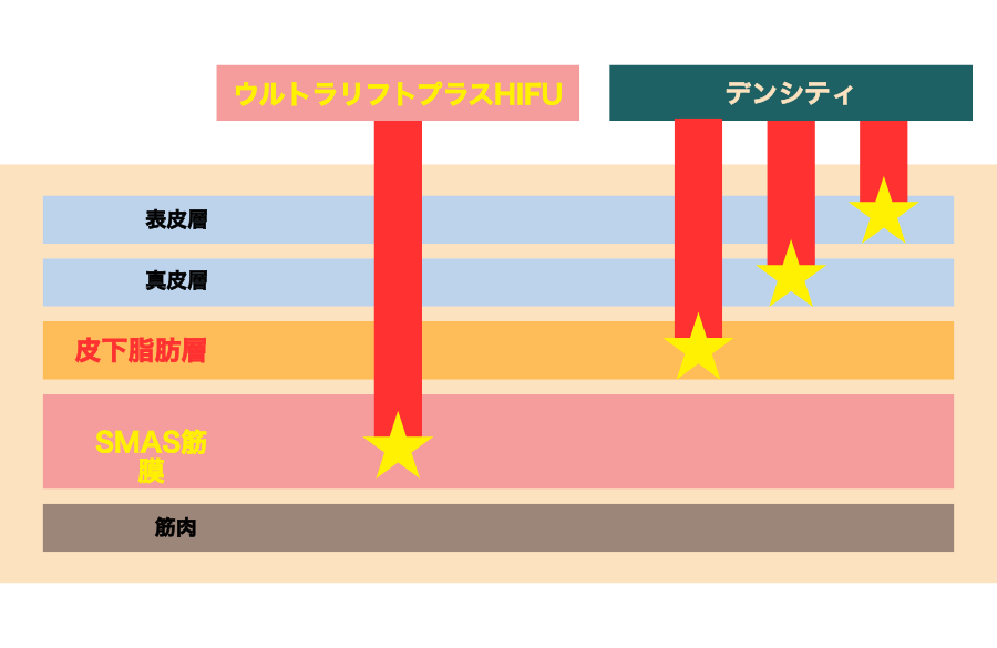 照射する層の違い