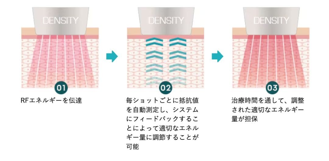 理由②:気になる「ゆるみ」の根本にアプローチ