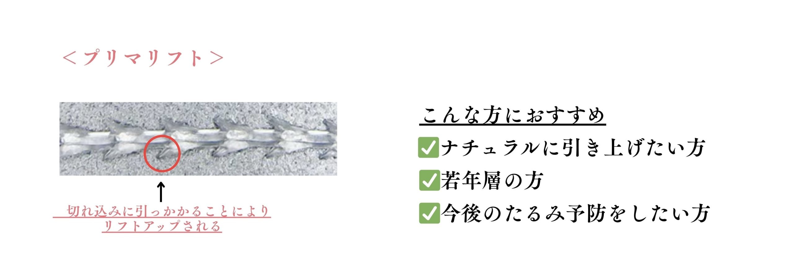 プリマリフト