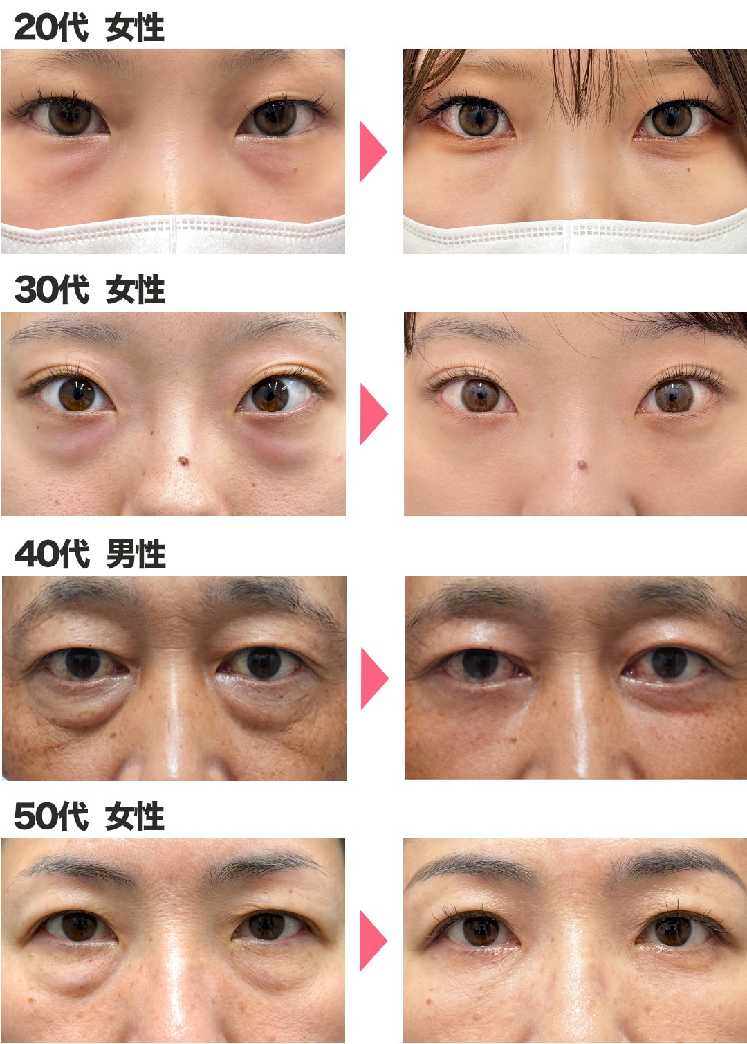 まずは、上岡院長の美しい症例をご覧ください