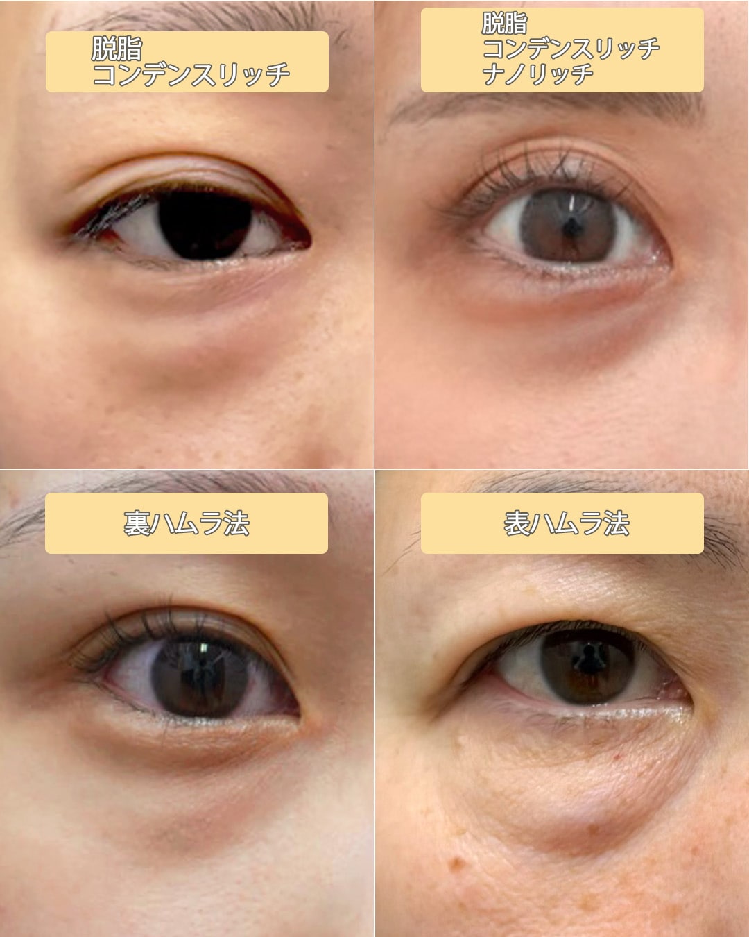 【悩み別】クマ治療一覧