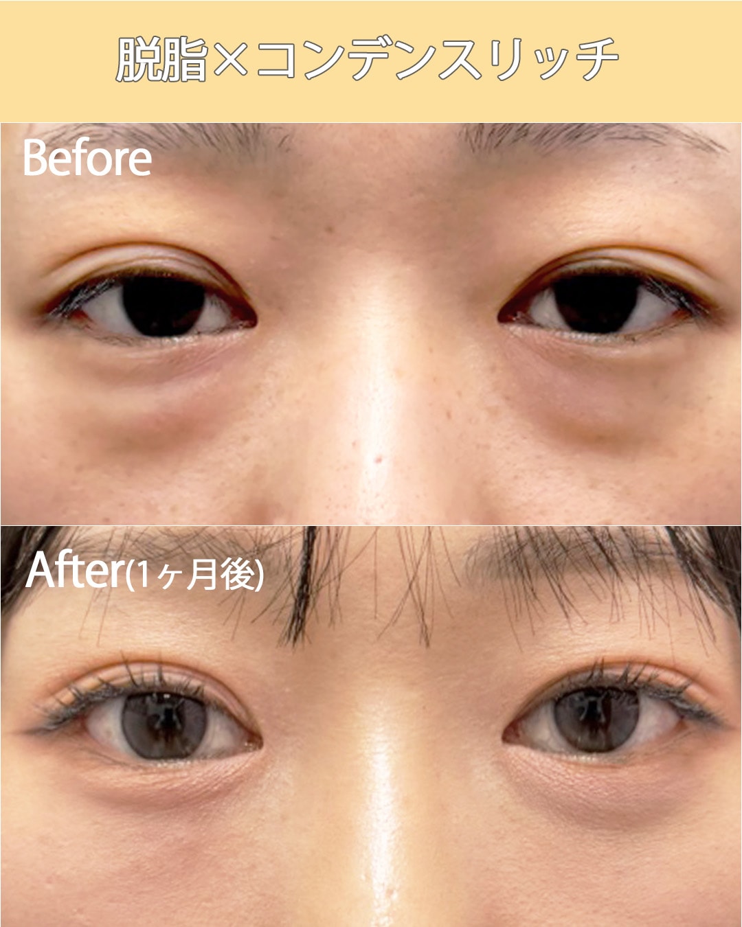 ①脱脂×コンデンスリッチ