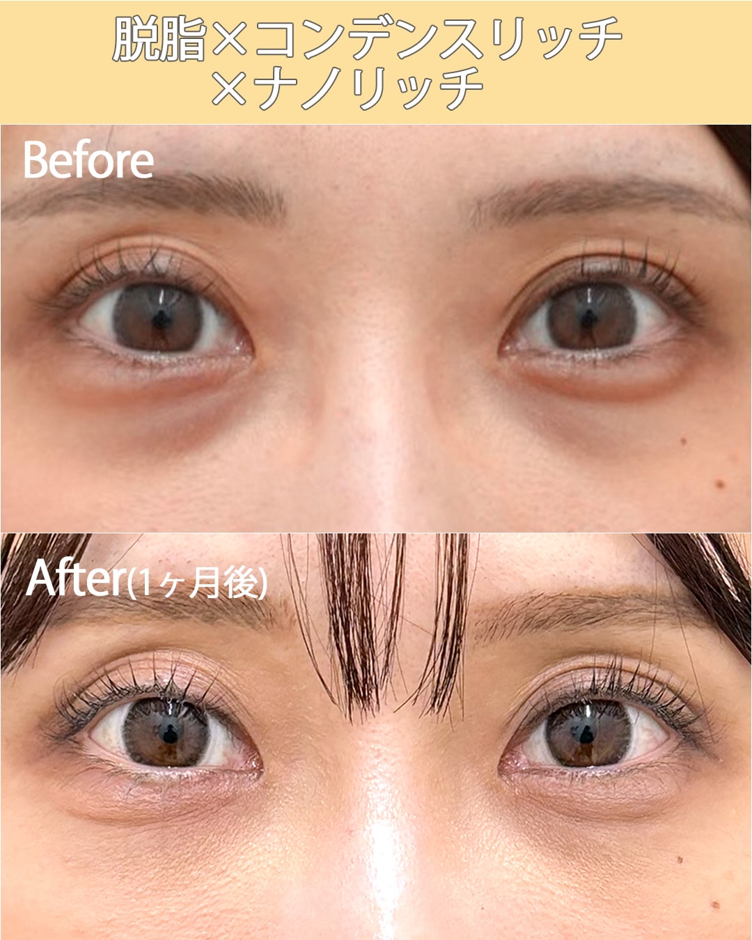 ②脱脂×コンデンスリッチ×ナノリッチ