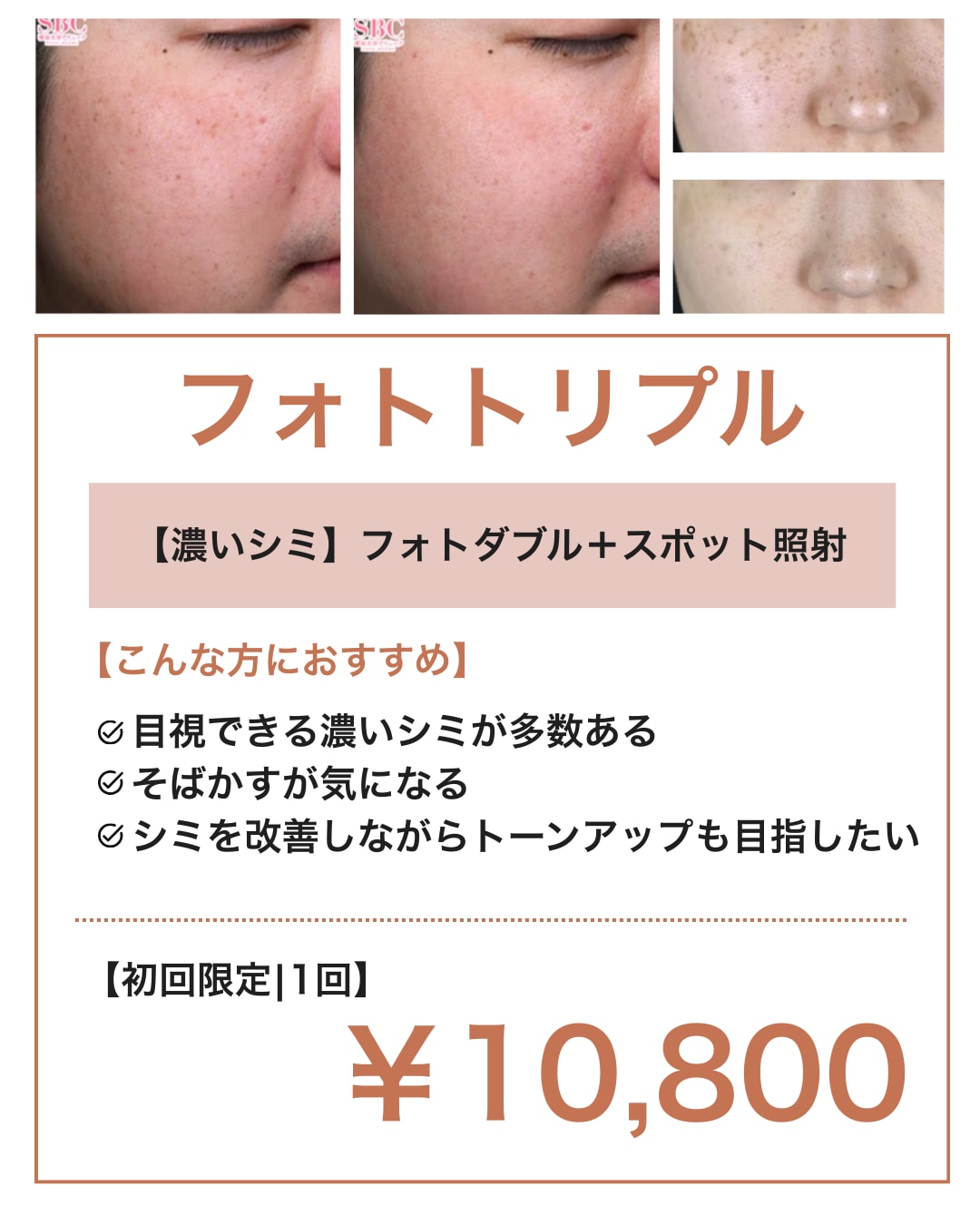 フォトトリプル