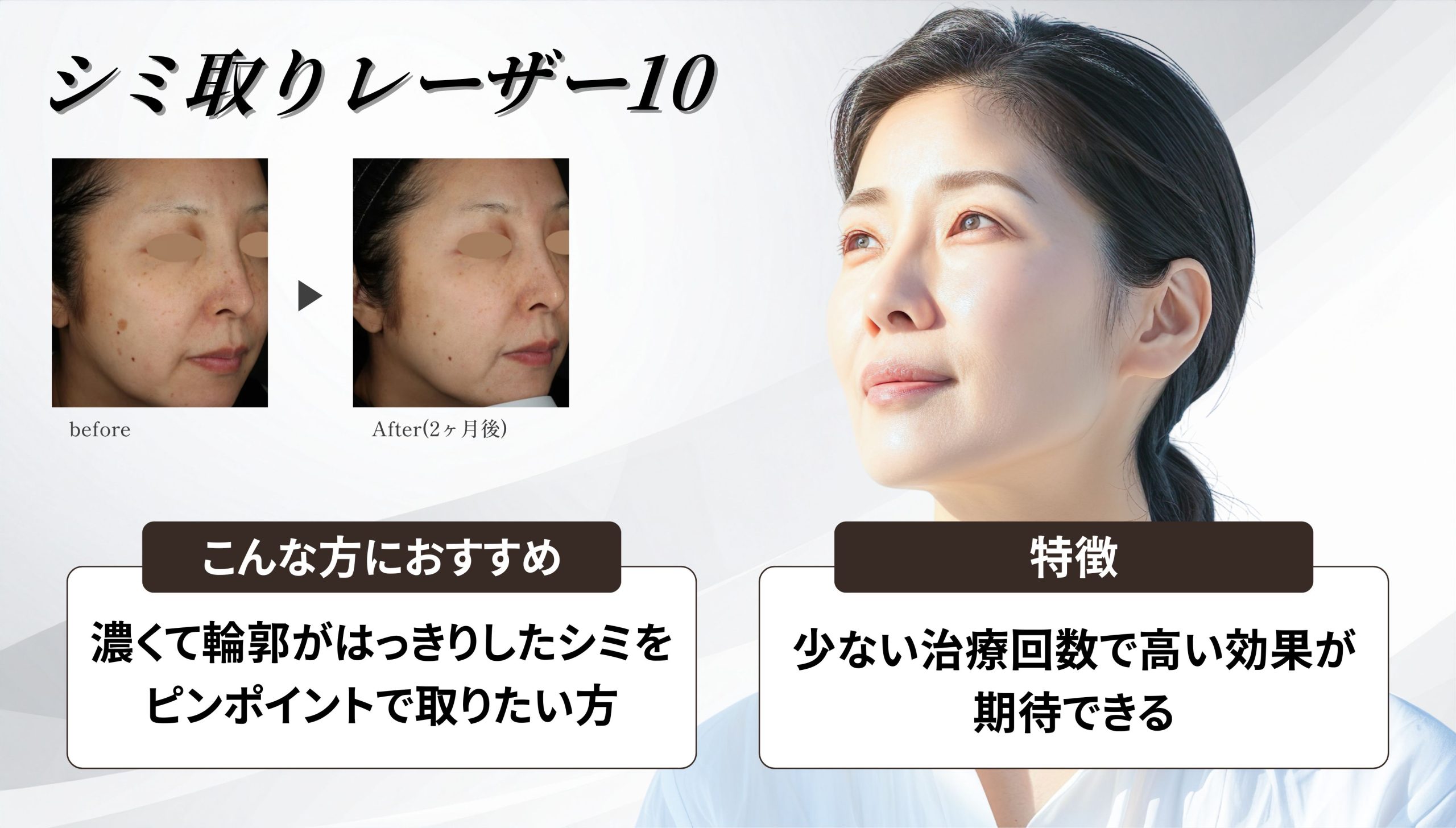 ① シミ取りレーザー