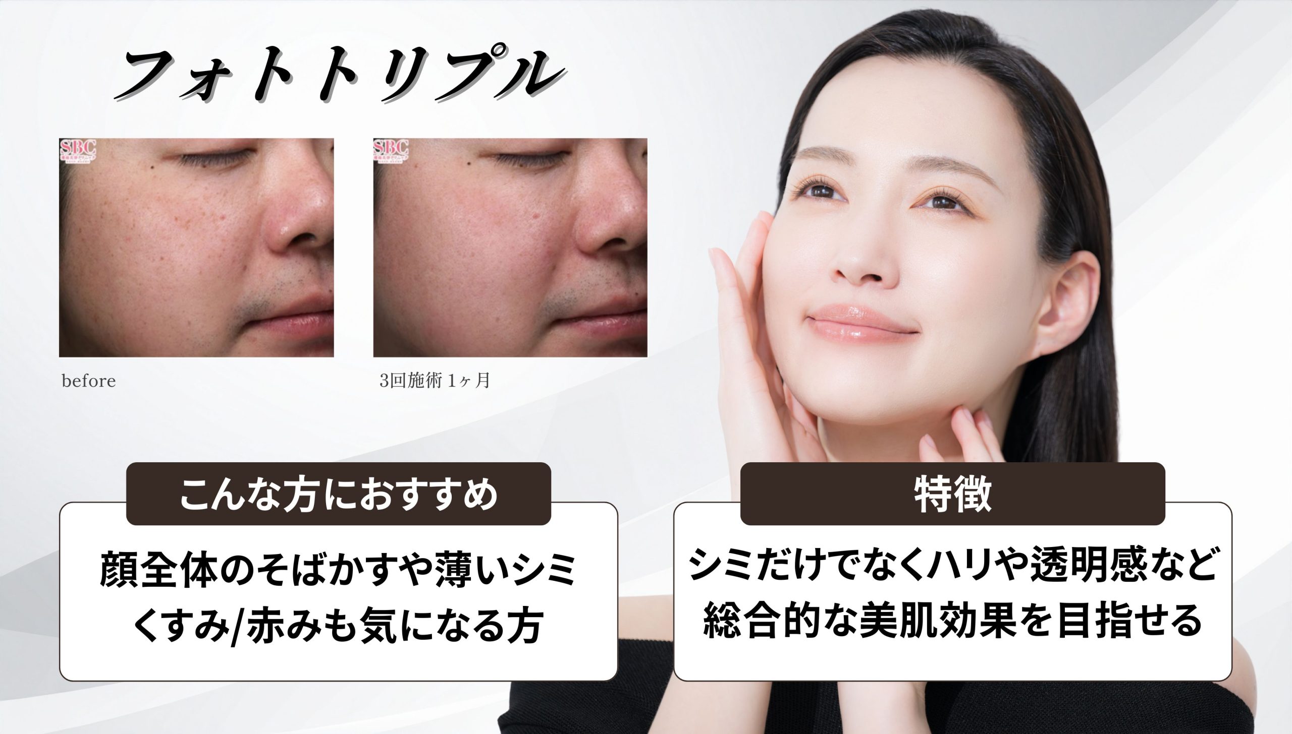 ② フォトトリプル(IPL治療)