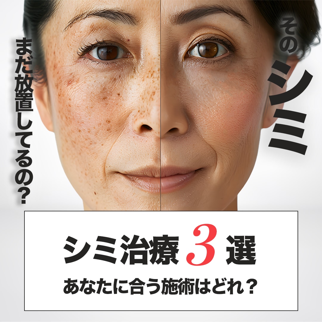 湘南美容クリニック蒲田院で始める本気のシミ治療3選｜あなたに合う施術はどれ？