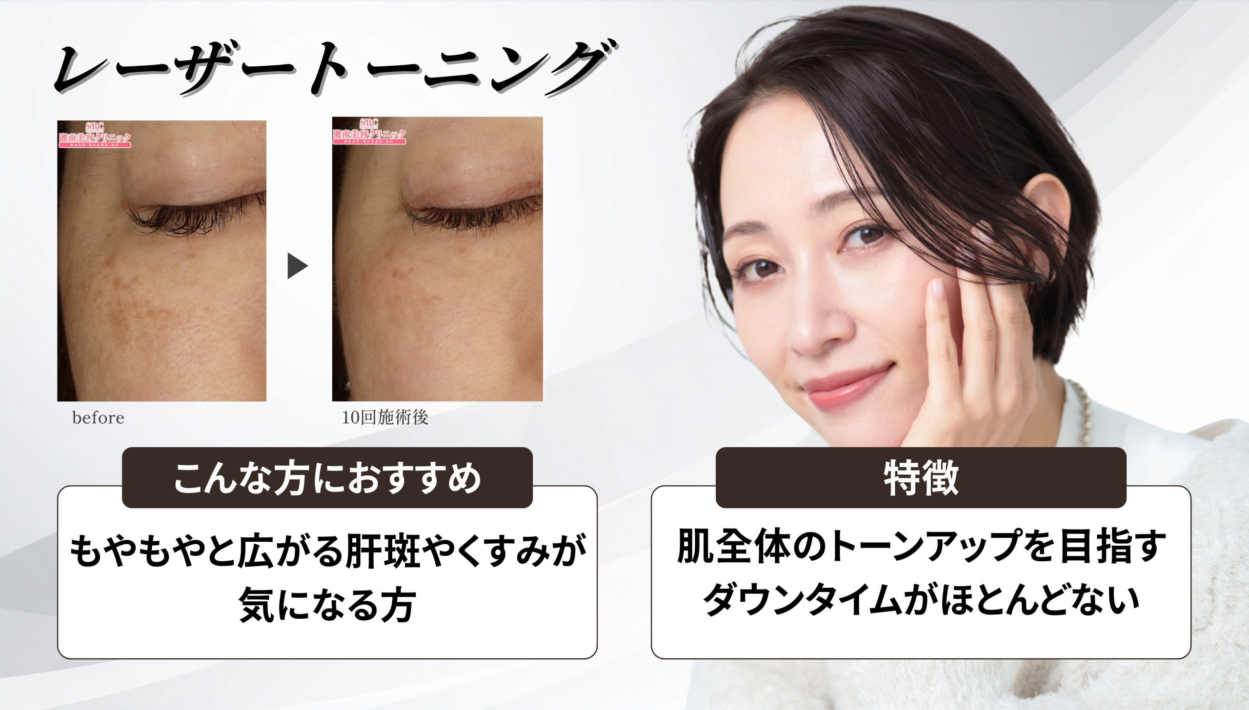 ③ レーザートーニング