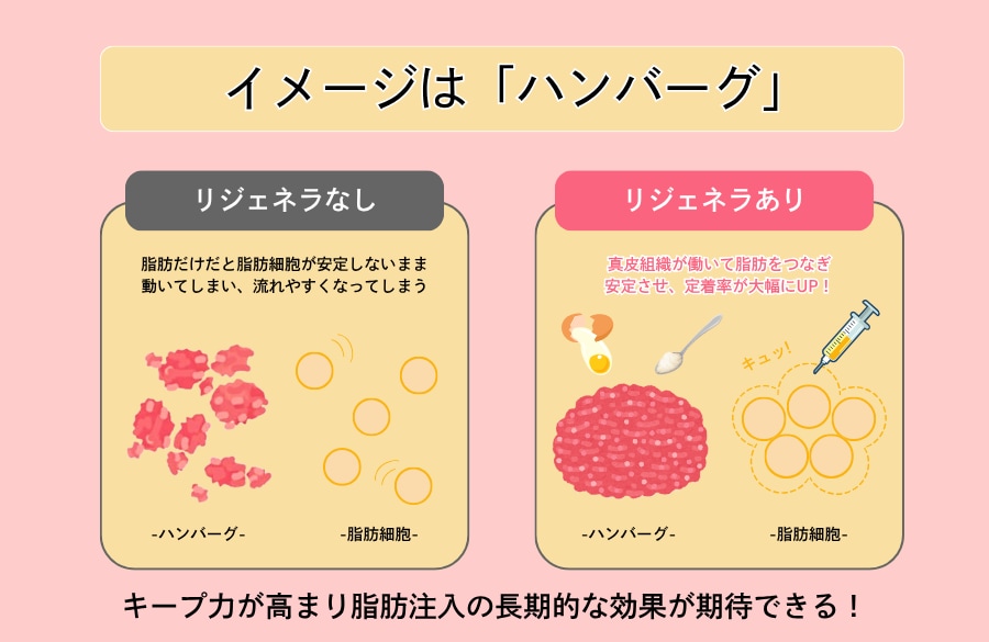 理由1：【最重要】脂肪の「定着率」の最大化が期待できる