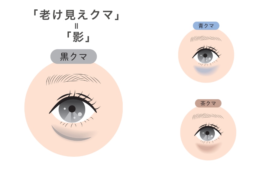 原因①：「老け見えクマ」の正体は「影」