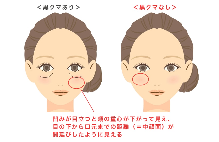 原因②：「面長印象」は「頬の重心」の低下