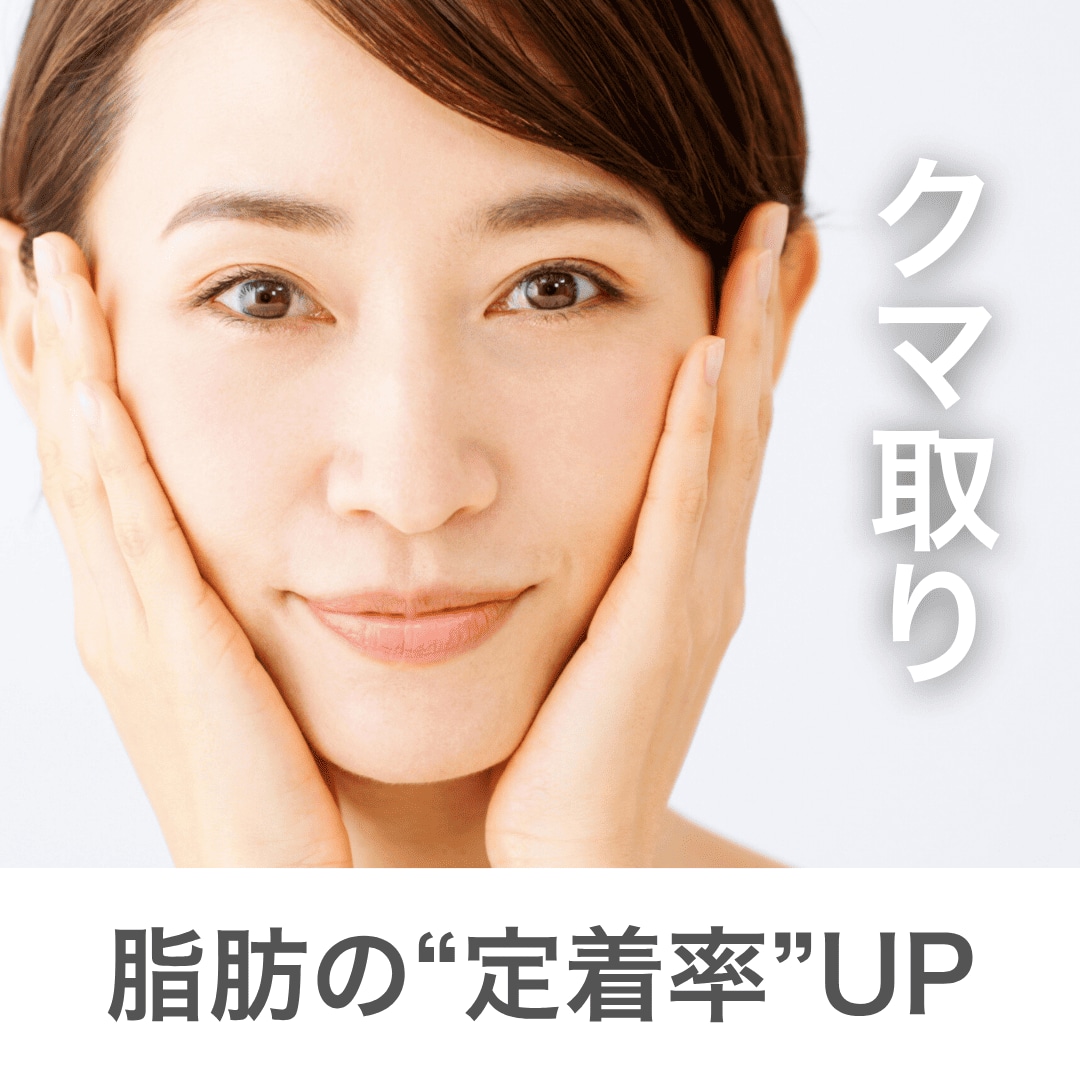 《クマ治療》その脂肪注入、無駄にしない。「定着率」にこだわる湘南美容クリニック蒲田院の“賢い一手”『リジェネラ』を徹底解説