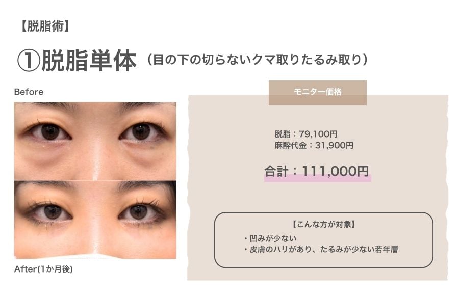 ①脱脂単体（目の下の切らないクマ取り・たるみ（ふくらみ）取り）