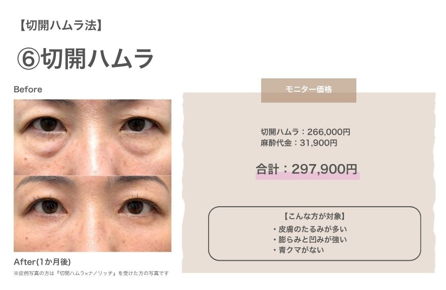 ⑦切開ハムラ単体