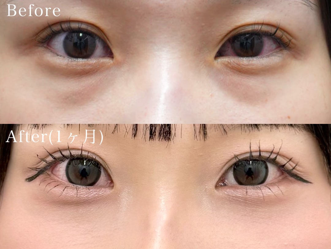 ③20代女性 裏ハムラ