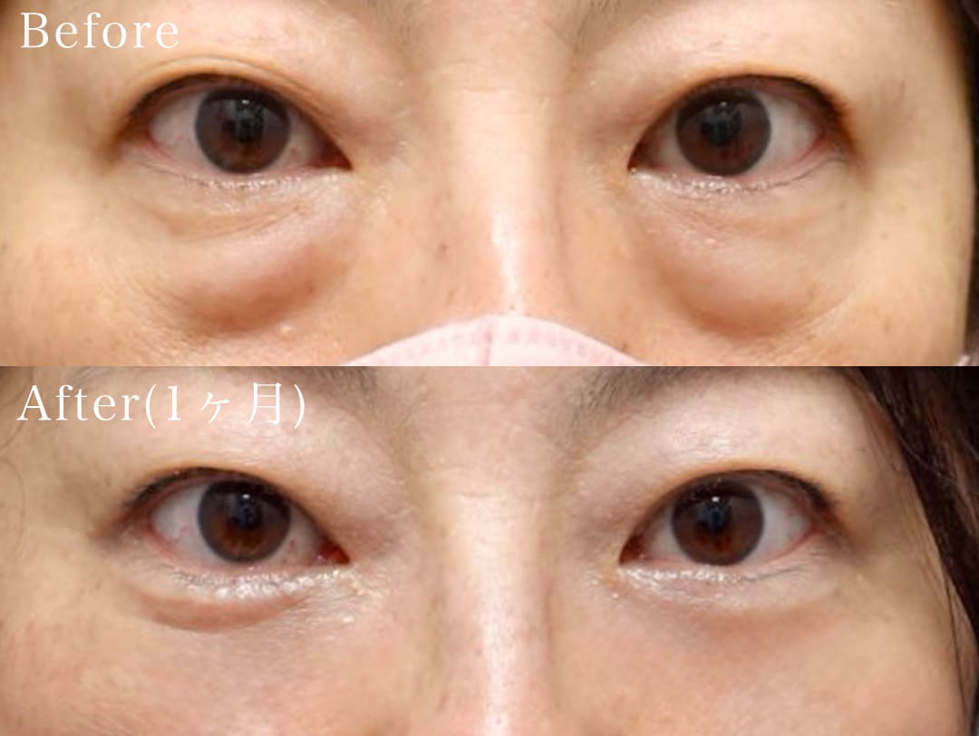 ①50代女性 裏ハムラ