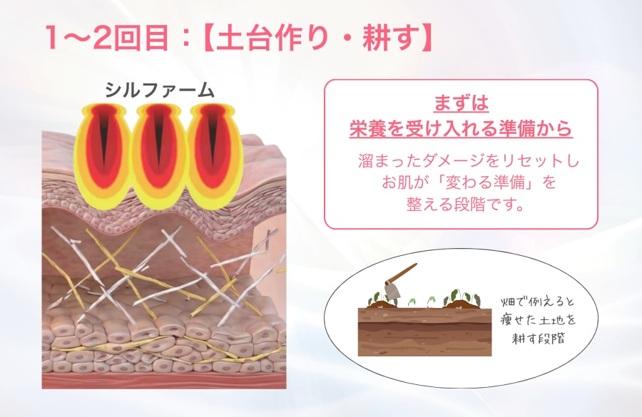 alt="湘南美容クリニック蒲田院 シルファームX1~2回目は土台作り解説画像"