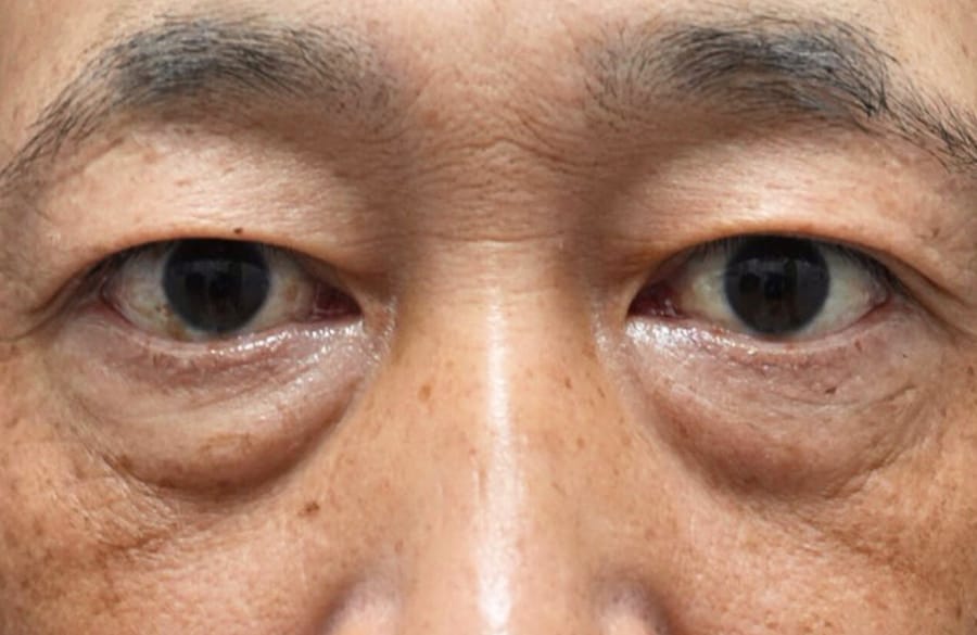 睡眠やスキンケアでは解決できない「物理的な影」の真実