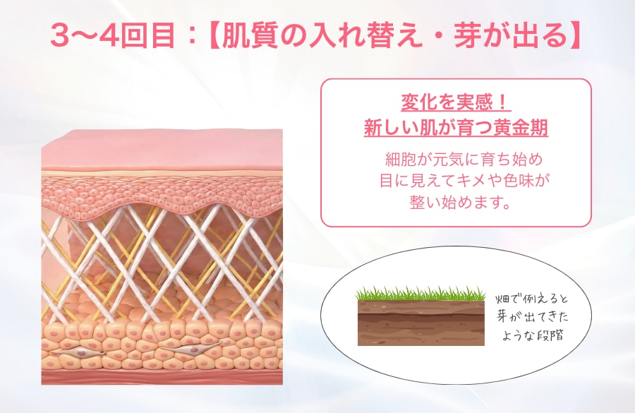 alt="湘南美容クリニック蒲田院 シルファームX3~4回目は肌質の入れ替え解説画像"