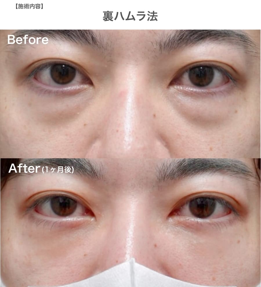 20代　【裏ハムラ】