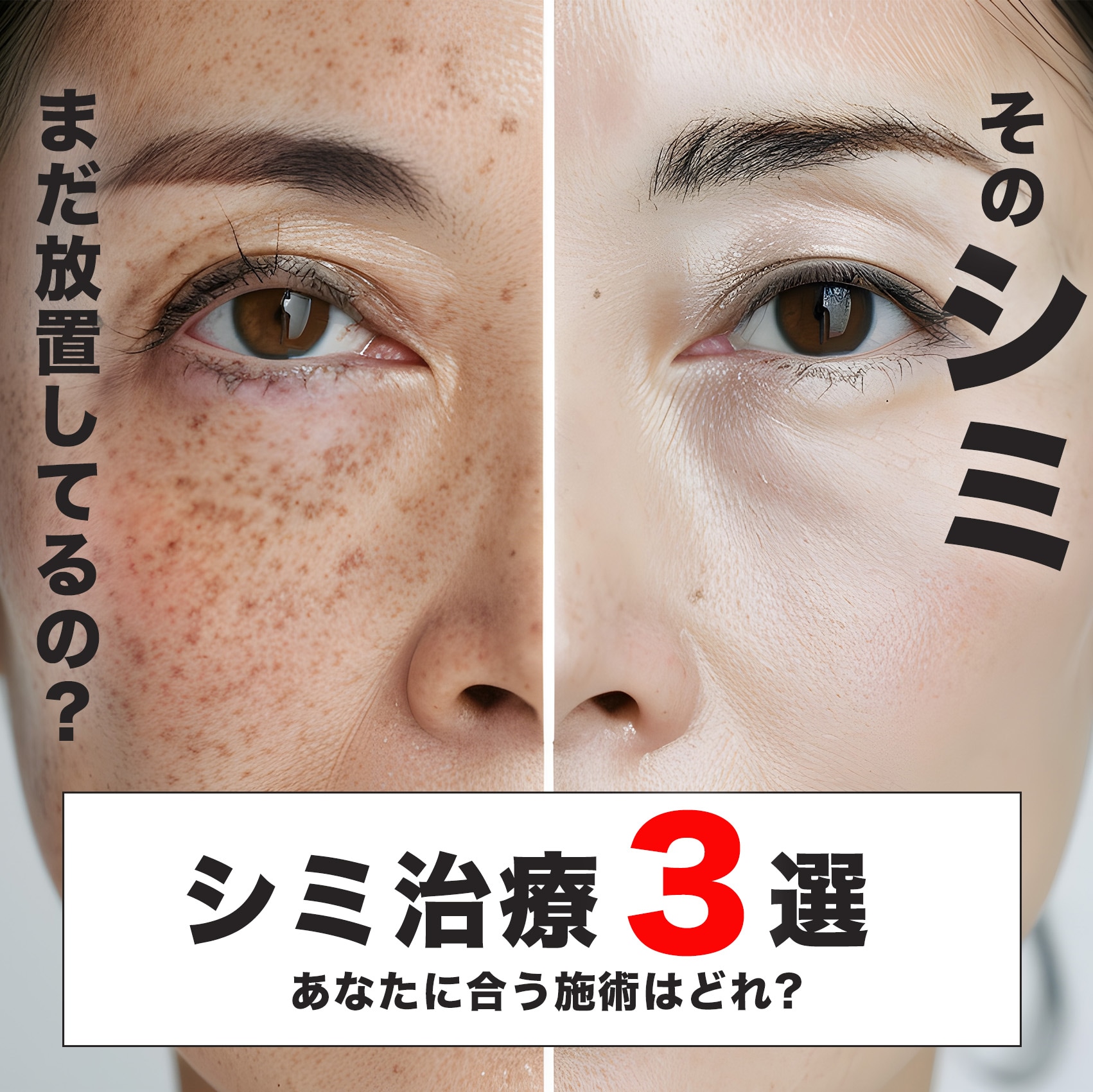 蒲田でシミ取りなら！湘南美容クリニック蒲田院のシミ治療3選｜フォトフェイシャル・トーニング・シルファームを徹底比較