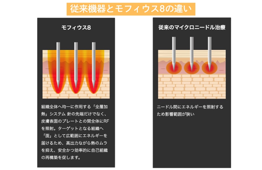 ☑️深層へのアプローチ
