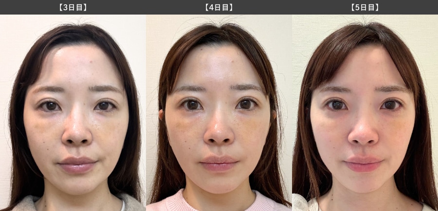 【3日目〜5日目】