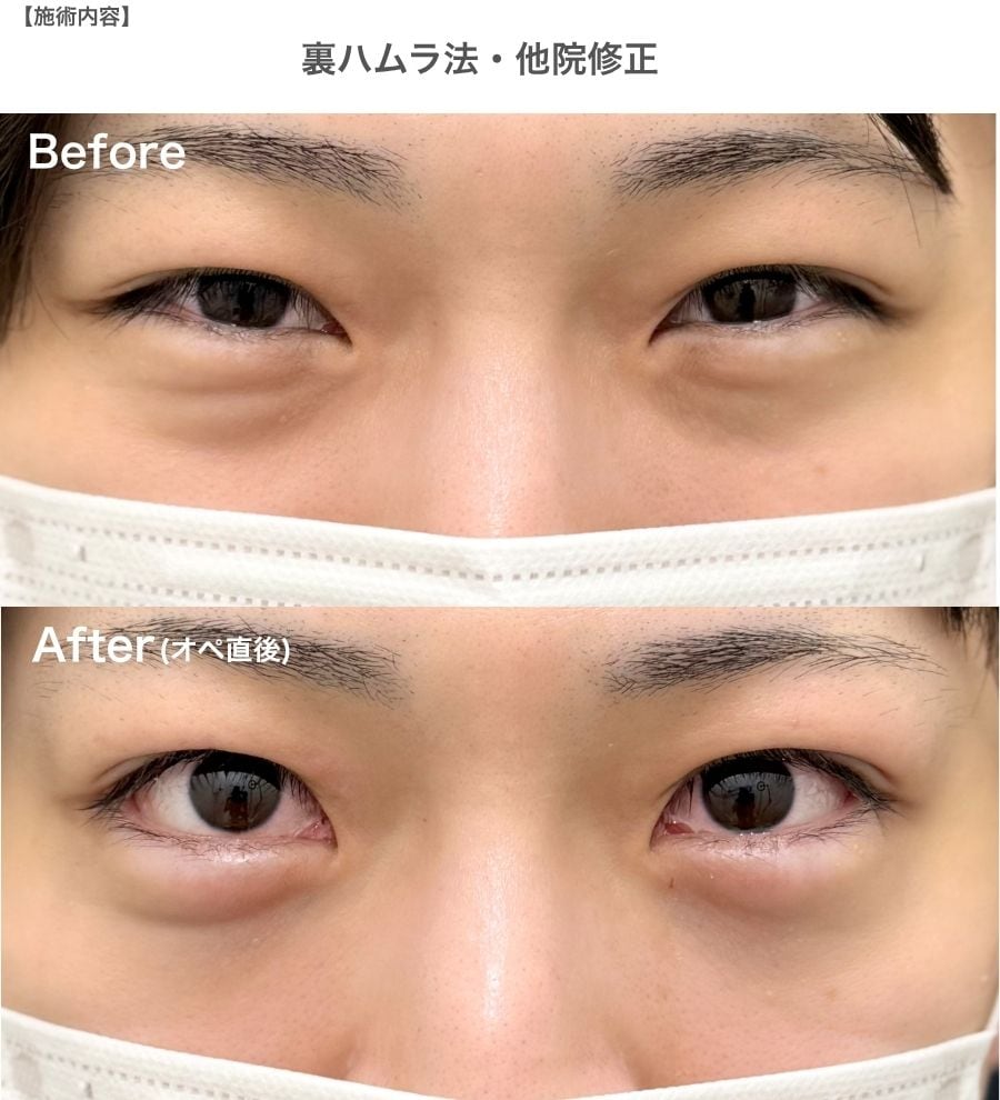 【他院修正】難しい骨格への再アプローチ