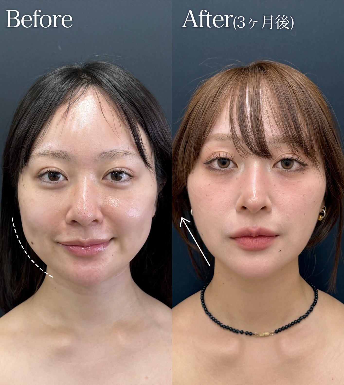 20代女性